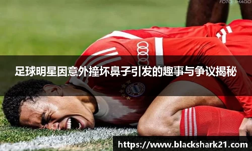 足球明星因意外撞坏鼻子引发的趣事与争议揭秘
